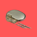 Image of a pacemaker